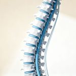 Spine injury medical illustration